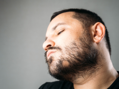 Beard Transplant