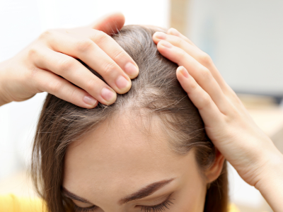 Female Hair Transplant