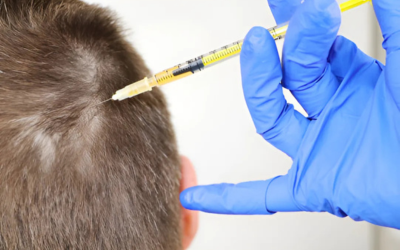 PRP (Platelet-Rich Plasma)
