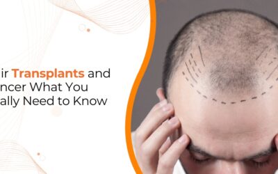 Can Hair Transplant Cause Cancer