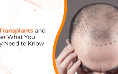 Can Hair Transplant Cause Cancer