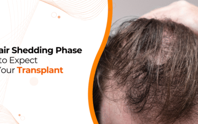What is the Shedding Phase After Hair Transplant?