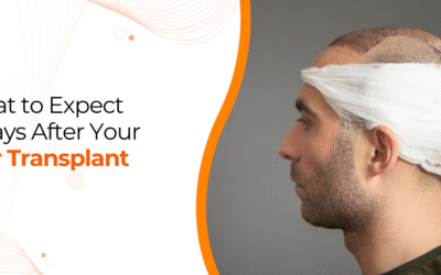 7 Days After Hair Transplant