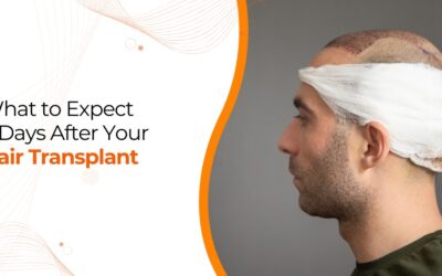 7 Days After Hair Transplant