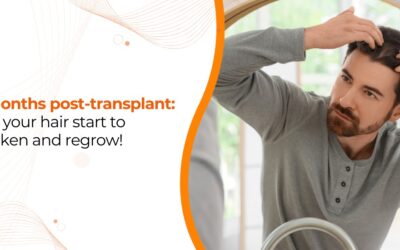 Hair Transplant After 2 Months